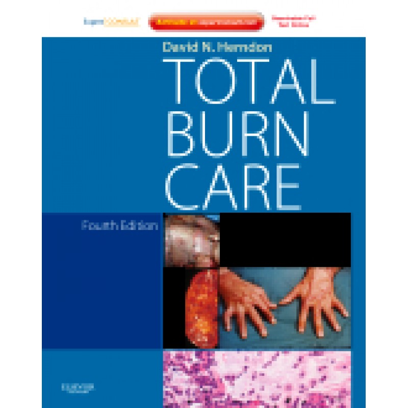 Total Burn Care, 4th Edition - Expert Consult - Online and Print